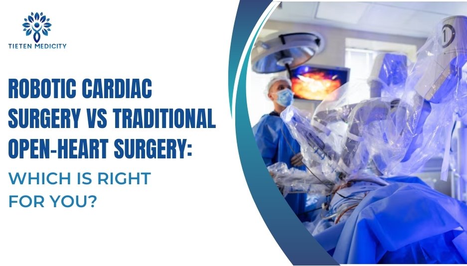 Robotic Cardiac Surgery vs. Traditional Open-Heart Surgery: Which is Right for You?