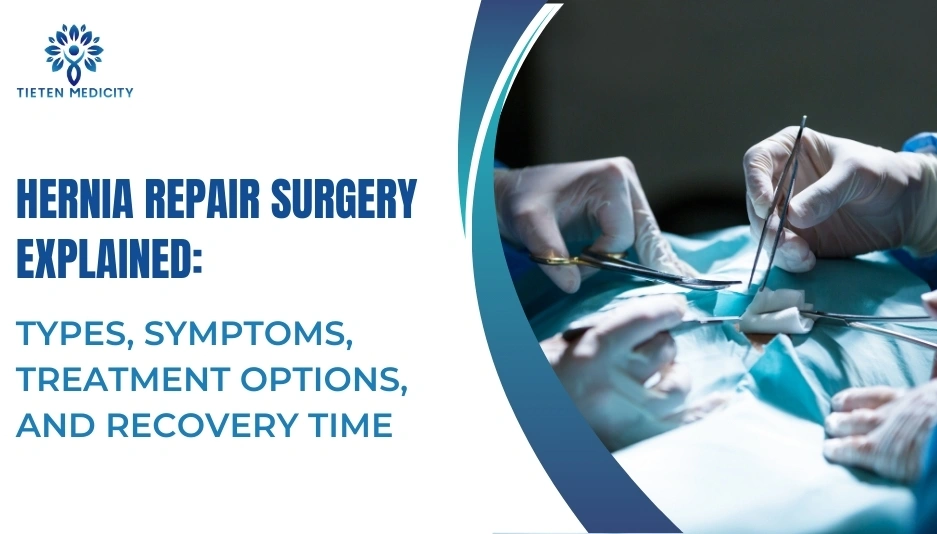 Hernia Repair Surgery Explained: Types, Symptoms, Treatment Options, and Recovery Time
