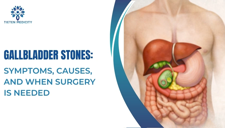 Gallbladder Stones: Symptoms, Causes, and When Surgery Is Needed