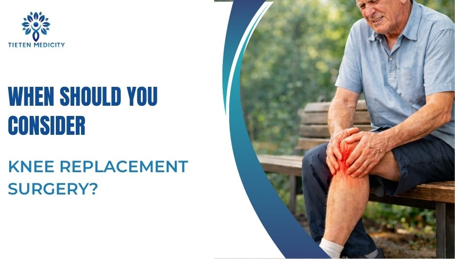 When Should You Consider Knee Replacement Surgery?